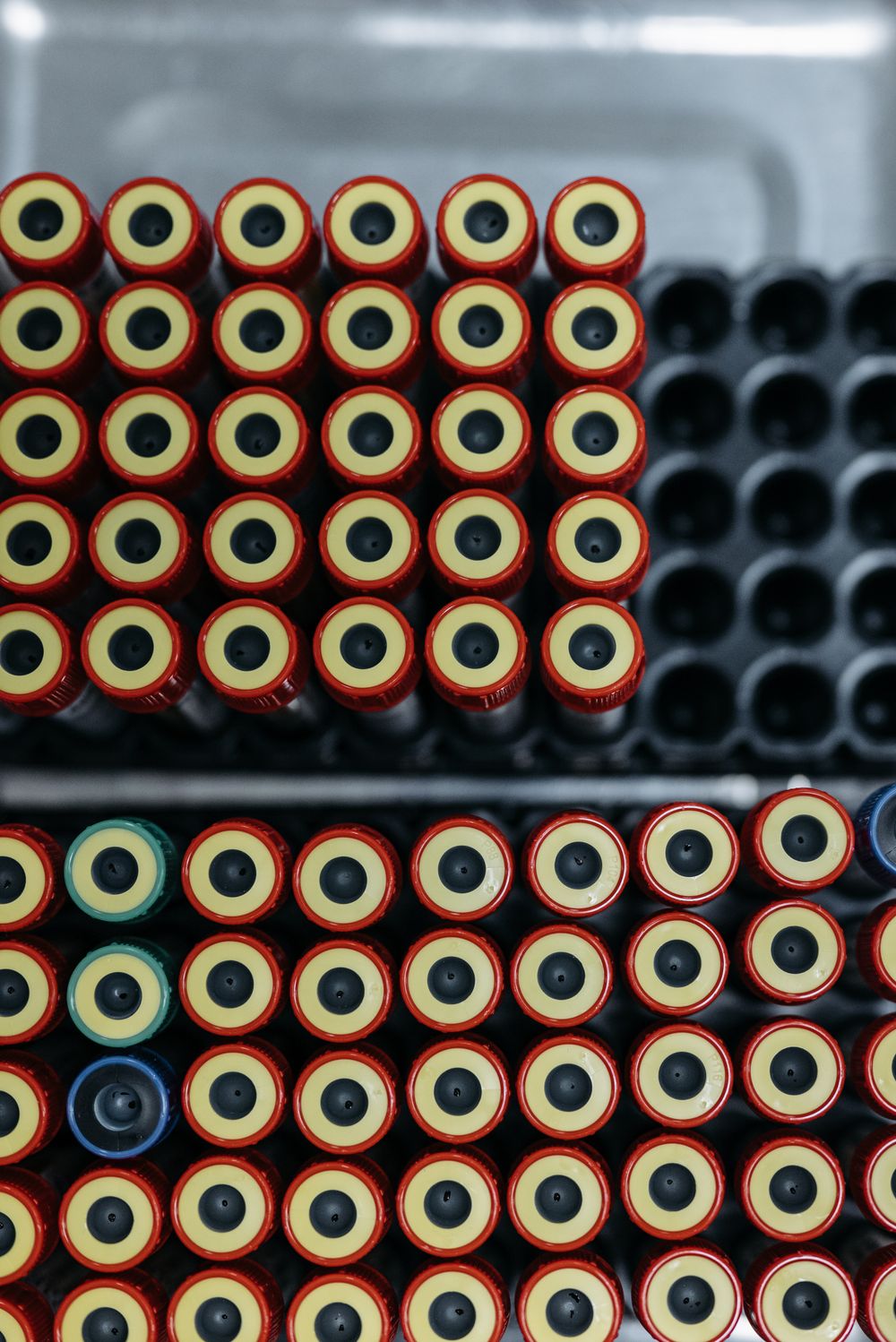 Laboratory specimen tubes arranged in a rack